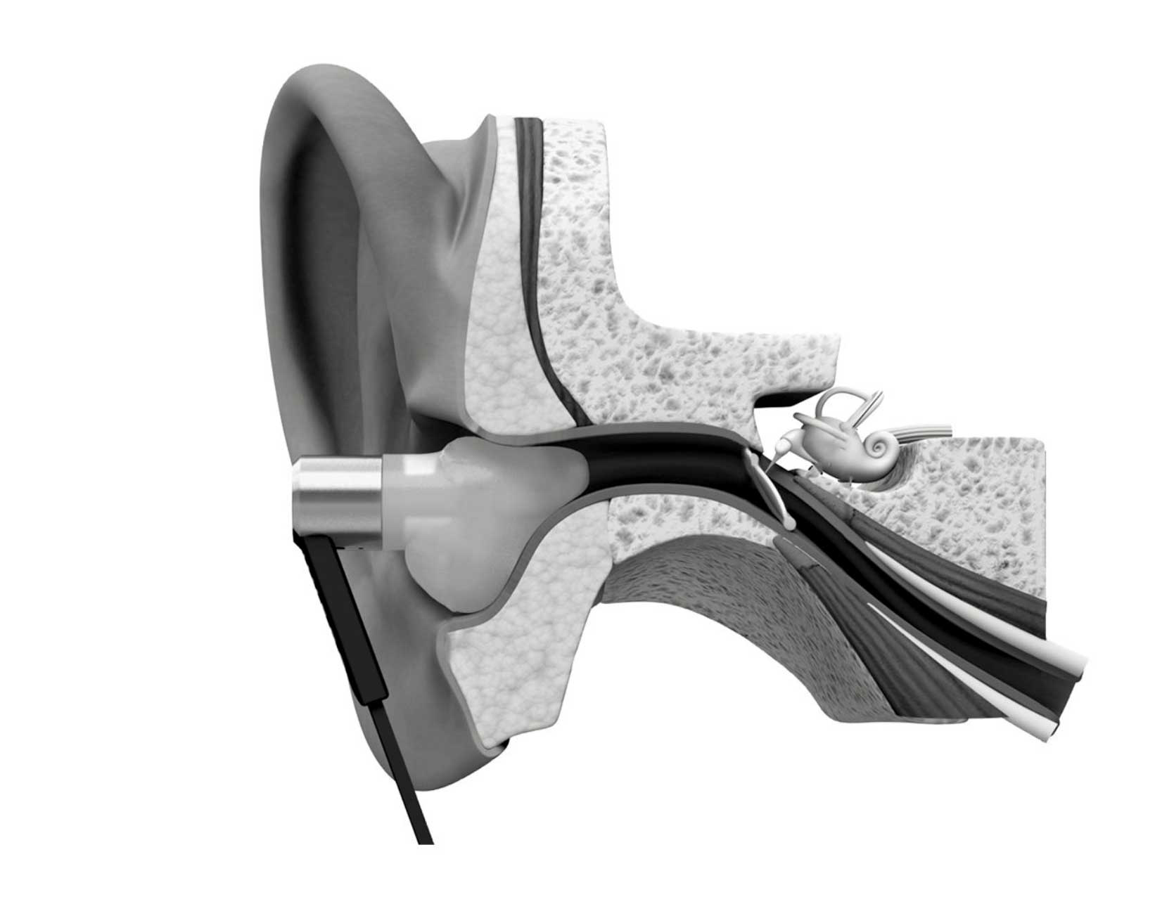 Lantos-Ear2 cropped RIGHT